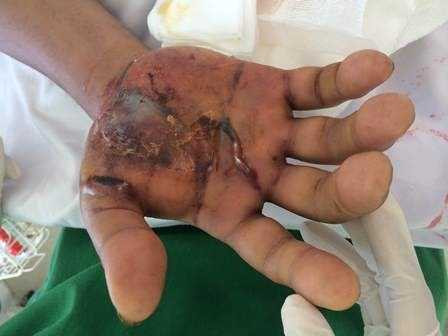 Rắn lục đuôi đỏ tấn công dân Hà Nội, làm sao để đuổi?