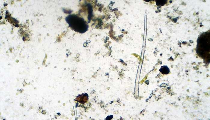 Loài vật này sống ký sinh bằng cách thu nhận ADN của vật chủ nó bám vào. Mỗi lần làm việc này, tuổi thọ của nó càng tăng lên và trở thành loài vật sống rất lâu 