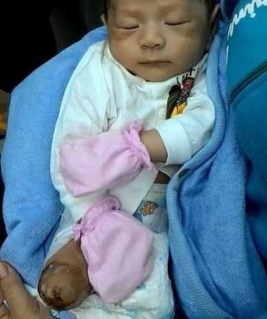 Bé trai văng khỏi bụng mẹ giờ ra sao?