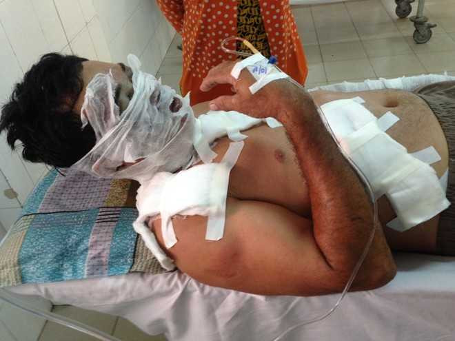 Vừa bước xuống ôtô, chủ hãng nước đá bị tạt axít vào mặt