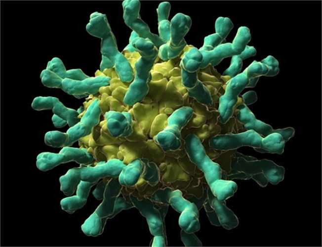 15. Virus gây bệnh bại liệt Poliovirus. Khi nhiễm vào cơ thể, Poliovirus lan vào hệ thần kinh trung ương, làm yếu các cơ và gây bại liệt.