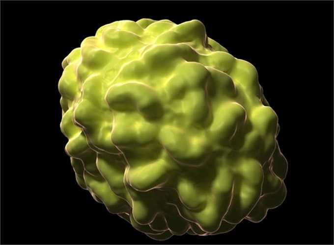 4. Bệnh đậu mùa là một bệnh truyền nhiễm cấp tính do virus Variola gây ra, bệnh đậu mùa là loại bệnh dễ gây thành dịch lớn, tỷ lệ tử vong cao. Đây là một trong các bệnh truyền nhiễm duy nhất đã được loại trừ trên toàn cầu. Căn bệnh này đã giết chết hàng triệu người và gây mù lòa ở hàng triệu người khác.