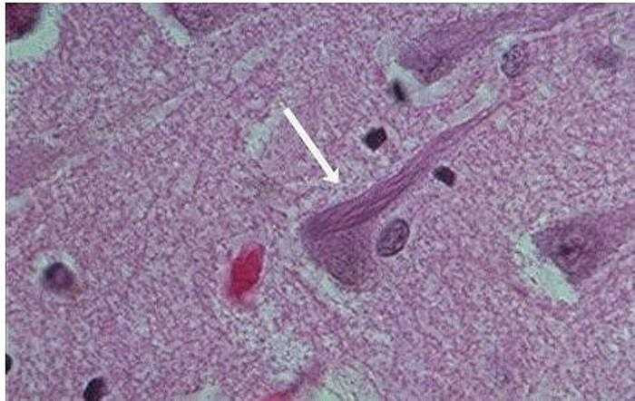 7. Loại virus Tây sông Nile là căn bệnh lây truyền qua các loài muỗi và có thể lây nhiễm cho cả người và động vật. Người mắc virus này sẽ có các triệu chứng sốt cao, đau đầu, khó thở, chóng mặt, ngừa ngáy, nôn..., 1% số người nhiễm virus này sẽ phát triển thành bệnh gây viêm não hay viêm màng não, 10 % trong số đó sẽ tử vong.