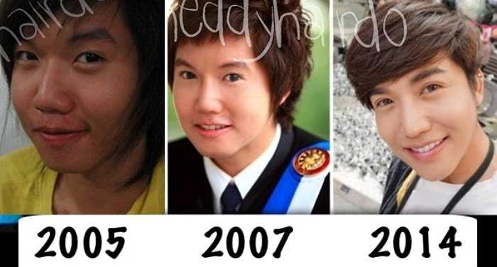 Thần tượng chàng ca sĩ lai Nichkhun (2PM), cô gái có nick name là Theddy (Thái Lan) đã phẫu thuật thẩm mỹ 8 năm và thay đổi phong cách ăn mặc sang tomboy để giống với idol xứ Hàn. Trải qua một thời gian dài dao kéo, hiện tại, Theddy đã có được khuôn mặt V-line, làn da trắng bóc, đôi mắt to, cùng gu thời trang sành điệu, cuốn hút.