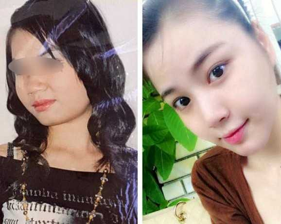 Phẫu thuật thẩm mỹ