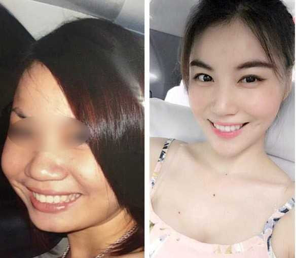 Phẫu thuật thẩm mỹ