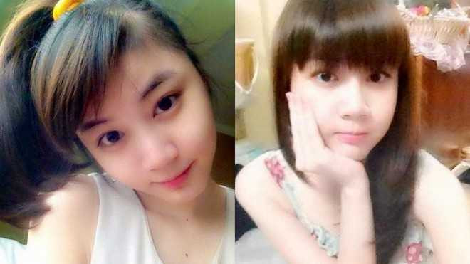 Phẫu thuật thẩm mỹ