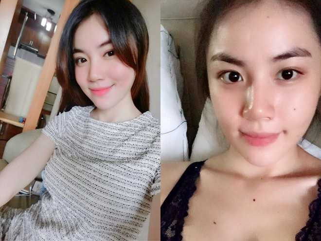 Phẫu thuật thẩm mỹ