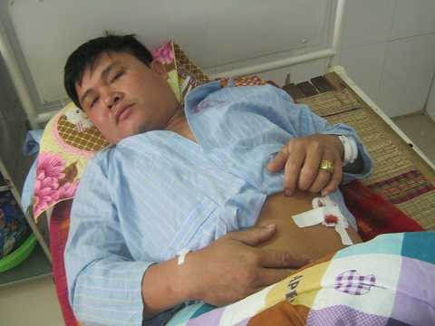 Hỗn chiến trong quán Karaoke: Nạn nhân kể giây phút bị bắn 3 phát đạn vào người