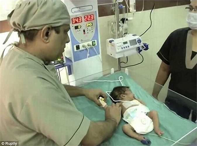 Theo các bác sỹ, bệnh Polymelia là do rối loạn xảy ra ở tử cung, quá trình em bé lớn lên trong bụng mẹ, các tế bào bất thường hình thành song song với quá phát triển của phôi thai.