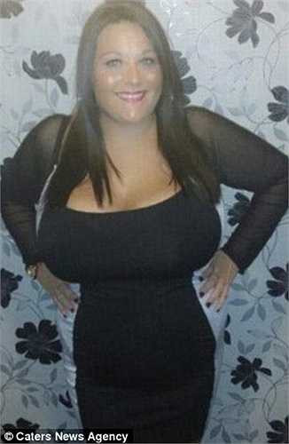 Kim Mills (32 tuổi), ngươì Anh đã có vòng 1 ngoại cỡ từ khi mới 14 tuổi.