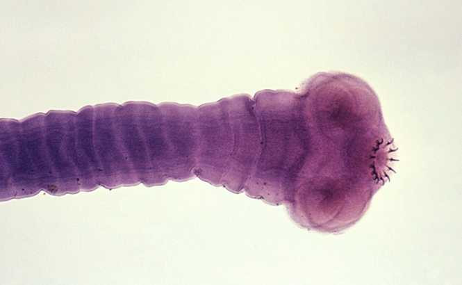 Hình dạng của con giun dài 2m 