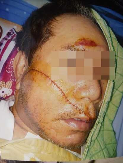 2 'sát thủ giấu mặt' vung mã tấu chém gục Việt kiều Mỹ