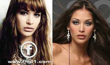 So sánh lại bức ảnh hồi xưa, nhiều người có thể nhận thấy chiếc mũi của cô đẹp và gọn gàng hơn rất nhiều