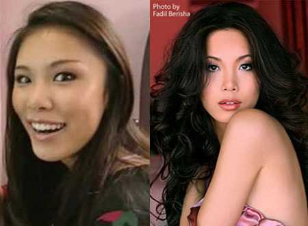 Riyo Mori thừa nhận bơm môi