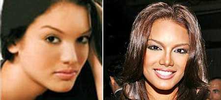 Zuleyka Rivera Mendoza có chiếc mũi kém thon gọn