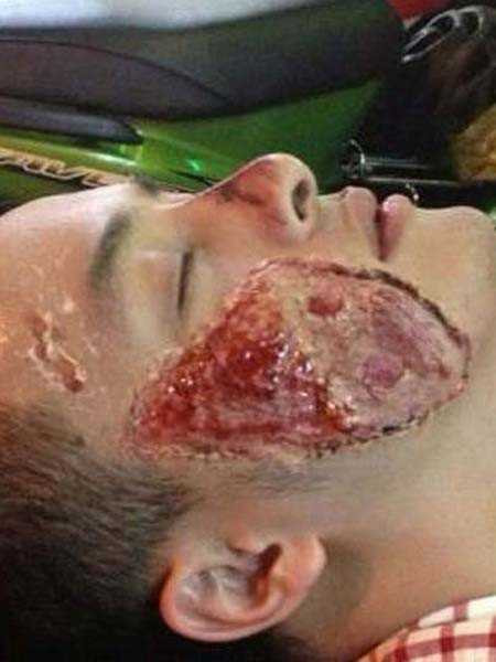 Cao Thái Sơn nói dối vụ tai nạn: Vào năm 2013, Cao Thái Sơn chia sẻ hình ảnh gương mặt bị rách một mảng lớn. Nam ca sĩ này cho hay, anh bị tai nạn và phải nhập viện điều trị, cuối năm mới có thể quay trở lại ca hát. Khi bị khán giả nghi ngờ về tính xác thực của thông tin, Cao Thái Sơn tuyên bố: "Chẳng ai điên mà muốn mình như thế này". Tuy nhiên, đó chỉ là trò đùa nhân ngày Cá tháng tư của Cao Thái Sơn. Hình ảnh đăng trên trang cá nhân được anh lấy ra từ MV của mình. 