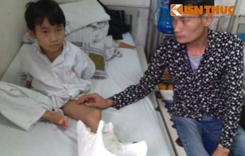 Tường bao trường chuẩn quốc gia sập đè nát chân học sinh