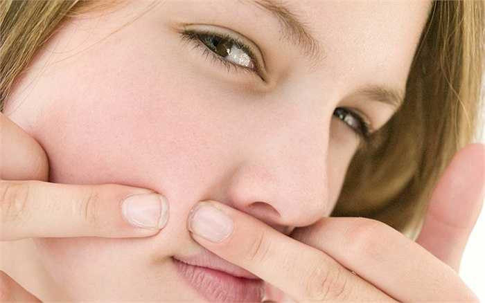 Trị mụn thái quá: Trị mụn nhiều sẽ khiến các vùng da mặt khác cũng bị ảnh hưởng, làm da đổ dầu và thêm thô ráp. Hãy dùng chút nghệ tươi hoặc tỏi để thoa lên vết mụn, chờ cho mụn xẹp và nhớ đừng chạm tay lên vết mụn. 