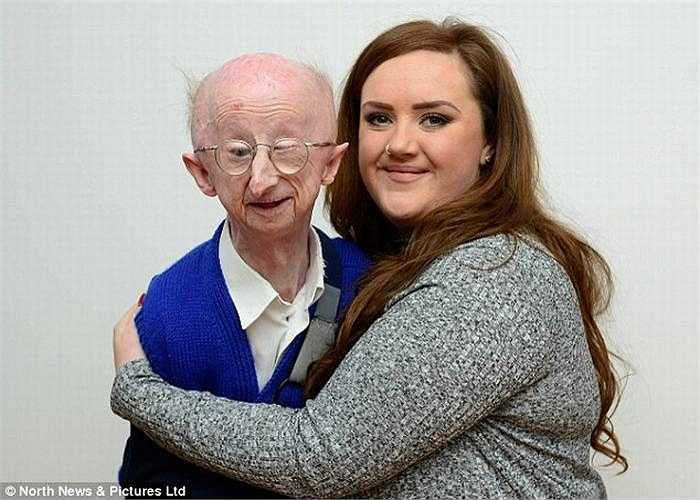 Ông Alan Barnes năm nay 67 tuổi nhưng ông chỉ nhỏ bé như một đứa trẻ với chiều cao 1m40 và cân nặng chưa tới 38kg. 