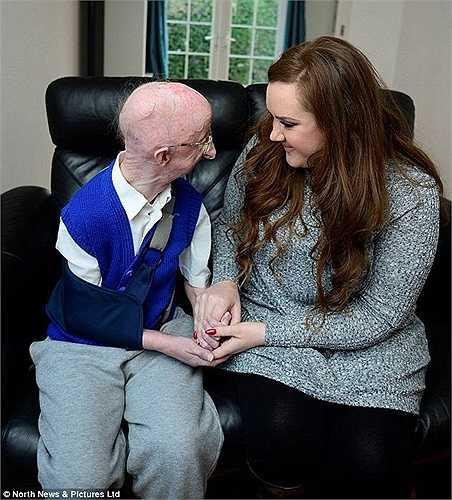 Ông vội sang nhà hàng xóm và được đưa tới bệnh viện. Alan bị gãy xương và cần 2 tháng để hồi phục vết thương và trong thời gian đó ông không thể tự làm bất cứ điều gì. 