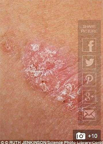 Khi mặc đồ bơi đến hồ bơi công cộng, cô đã bị nhân viên cứu hộ không cho vào hồ bơi. 