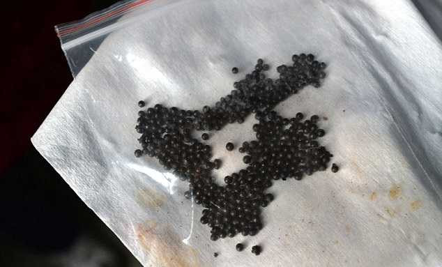 Những viên đạn được gắp ra