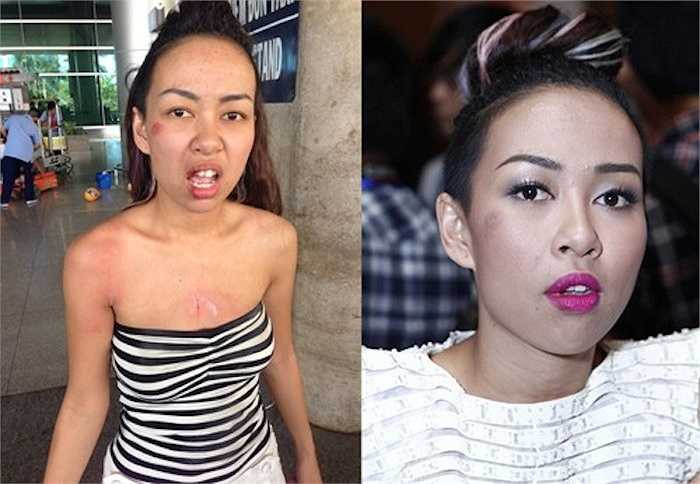 Đầu tháng 4/2014, khi đi đón em trai tại sân bay Tân Sơn Nhất (TP HCM), nữ ca sĩ Thảo Trang bị hai thanh niên đi ngược chiều giật túi xách. Trong khi cố gắng giành lại tài sản, cô bị ngã xuống đất và phải đi chỉnh răng. 