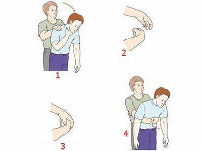  Xử lý sự cố hóc dị vật đúng cách sẽ mang lại cơ hội sống cho nhiều người. Ảnh: Dieutri.vn.