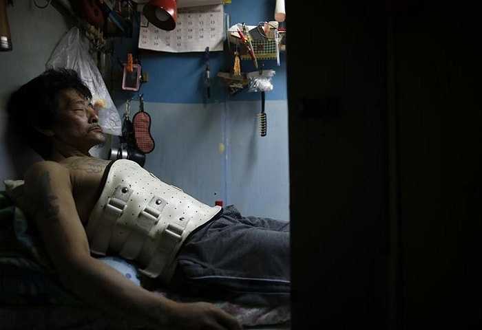 Ông Kam Chung 49 tuổi đang đeo thiết bị để giữ cột sống khi nằm trên chiếc giường trong phòng ở chật chội