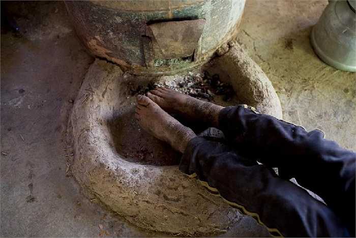 Cậu bé sưởi ấm đôi chân bằng tàn tro còn sót lại trên bếp