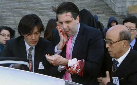 Đại sứ Mỹ tại Hàn Quốc Mark Lippert bị một kẻ quá khích tấn công bằng dao cạo ngay giữa trung tâm Seoul hôm 5/3