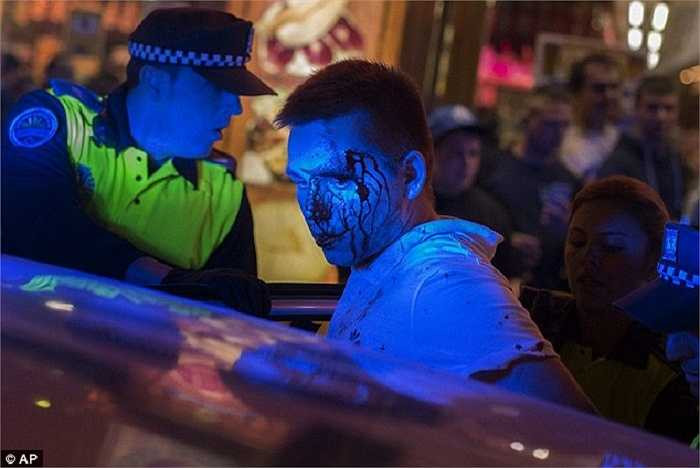 Cả 2 sau đó đã được đưa về trụ sở cảnh sát để xử lý. 