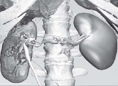 Chuyên gia mách 8 nguyên tắc vàng giúp khỏi bệnh thận