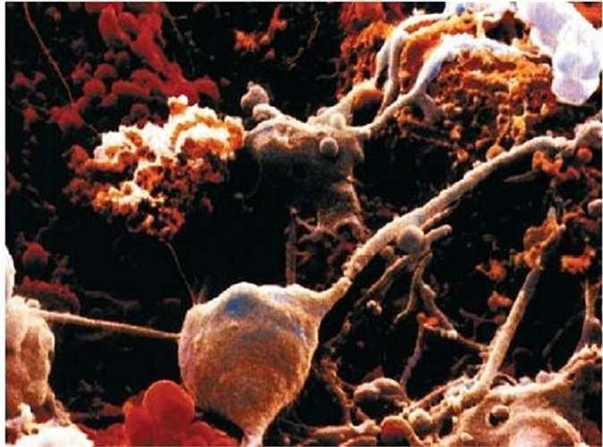 Các tế bào thần kinh ở não người.