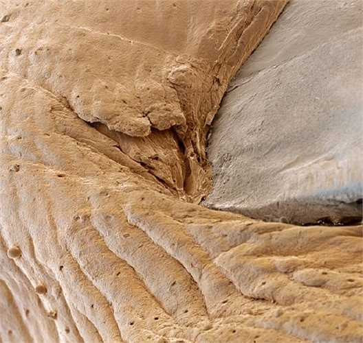 Tế bào sừng móng tay.