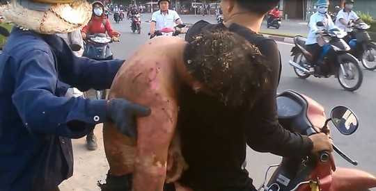 TP.HCM: Taxi từ chối chở nạn nhân đi cấp cứu