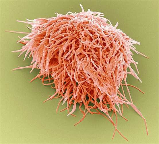 Chúng trông giống như một loài thực vật quý hiếm hay cảnh quan kỳ lạ nhưng hình ảnh thú vị này chính là các mảng vi khuẩn bám quanh răng và nướu.