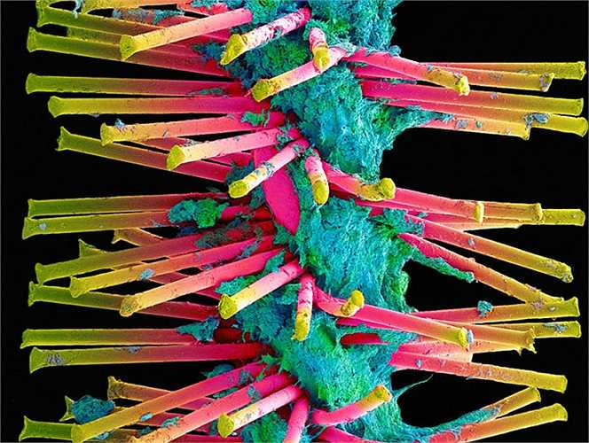 Một cái nhìn gần hơn của lông bàn chải được sử dụng để đánh bật các mảng bám ở kẽ răng.