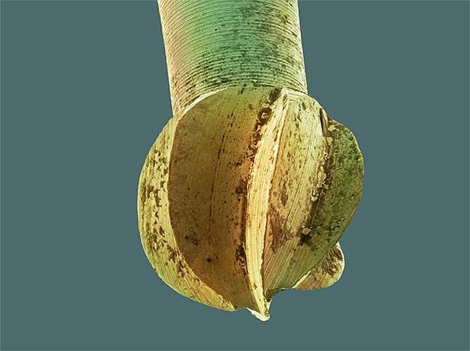 Khoan nha khoa được sử dụng để loại bỏ các mô mềm và vi khuẩn ở vùng bị sâu trước khi trám.