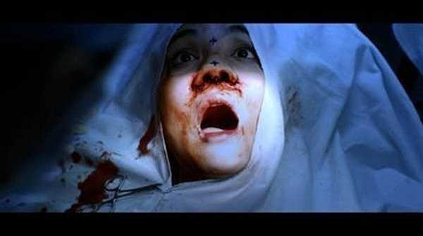 Khi lại biến dạng đến mức thảm hại bởi phẫu thuật thẩm mỹ.