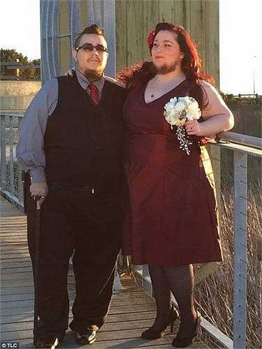 Annalisa phải tìm mọi cách loại bỏ, kể cả bằng laser nhưng không có hiệu quả lâu dài và cô phải sống trong cuộc chiến không hồi kết là cạo râu 2 lần/ngày.