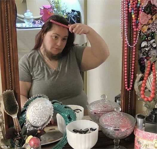 Annalisa đã đau khổ và hoàn toàn mất đi sự tự tin với cơ thể. Rất may cô đã tìm thấy một người đàn ông yêu và chấp nhận khuôn mặt khác người này. Kể từ đó, Annalisa không cạo râu nữa.