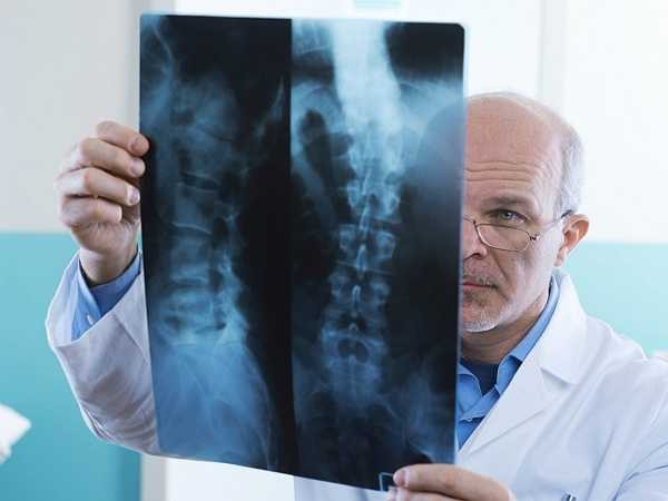 4. Chấn thương cột sống: Chỉ cần ngồi trong 20 phút với tư thế không đúng có thể gây ảnh hưởng đến cột sống, tạo áp lực cho các mô và cơ bắp xung quanh. Điều này dễ dàng dẫn đến chấn thương cột sống.