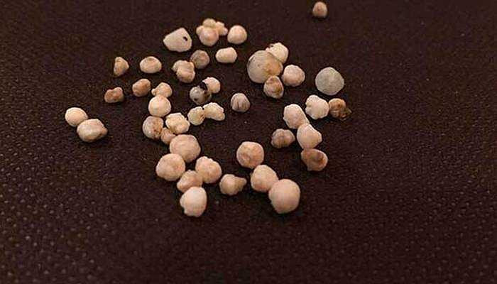 Các viên ngọc trai to, nhỏ có kích thước, độ mịn khác nhau