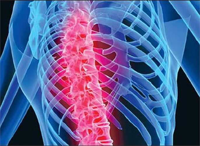 10. Loãng xương - thiếu ngủ cũng có thể làm tăng nguy cơ loãng xương. Theo một nghiên cứu năm 2012, mật độ khoáng trong xương sẽ giảm đáng kể ở người có chất lượng giấc ngủ kém.