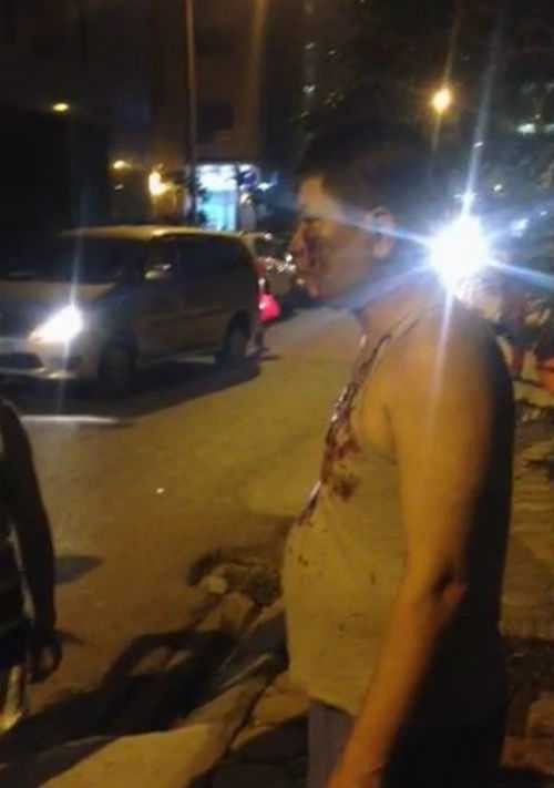 Chó Pit bull cắn chó Labrador tới chết: Người ngăn cản bị đánh lên tiếng