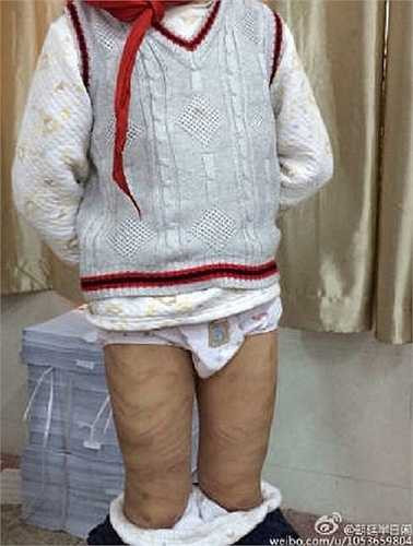 Theo chaotingbanrixian, đây không phải là lần đầu tiên cậu bé bị đánh nhưng trường học nghĩ rằng đây là một tai nạn nên câu chuyện của cậu bé không được công khai.