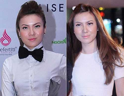 Những thay đổi này đã khiến dư luận đặt nghi vấn cô đã dùng botox hoặc chất làm đầy để da căng mọng hơn. Tuy vậy, nữ ca sĩ luôn phủ nhận việc mình đã nhờ tới công nghệ thẩm mỹ.