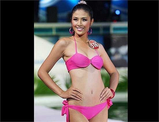 Bên cạnh đó là hàm răng khấp khểnh không đều